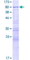 Human YTHDF2 Protein (Recombinant GST)