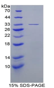 Mouse EIF3A Protein (Recombinant His-T7)