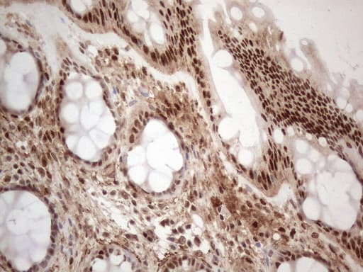 IRS1 Antibody (aa1-280, clone OTI3G10)