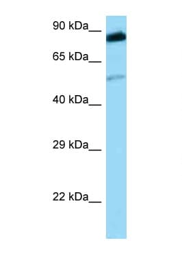 SRMS Antibody (aa211-260)