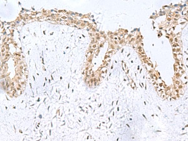 KDM2B / FBXL10 Antibody