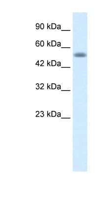 Polyclonal Rabbit anti-Human NUCB1 / Nucleobindin Antibody (C-Terminus, IHC, WB)