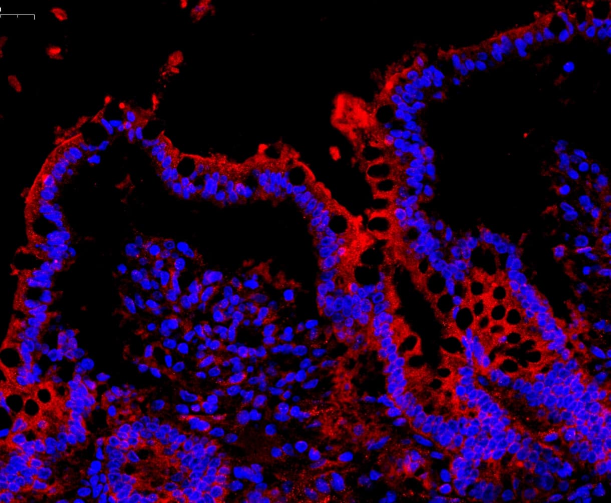 NALP3 / NLRP3 Antibody (aa12-31)