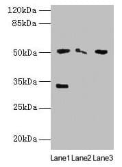 SLC38A6 Antibody