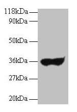 Polyclonal Rabbit Anti-Human Ig Light Chain Secondary Antibody (IHC, WB)