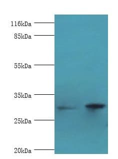 ACBD4 Antibody (aa1-305)