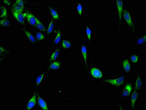 YES1 / c-Yes Antibody