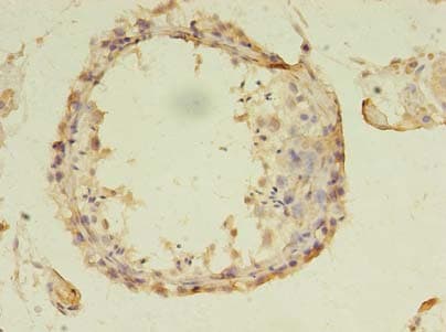 ASB13 Antibody