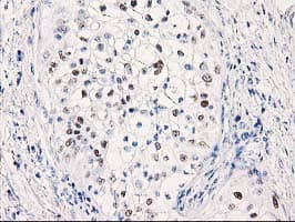 Monoclonal Mouse anti-Human TP53 / p53 Antibody (clone OTI3F5, IHC, IF, WB)