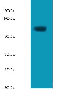 TGM2 / Transglutaminase 2 Antibody