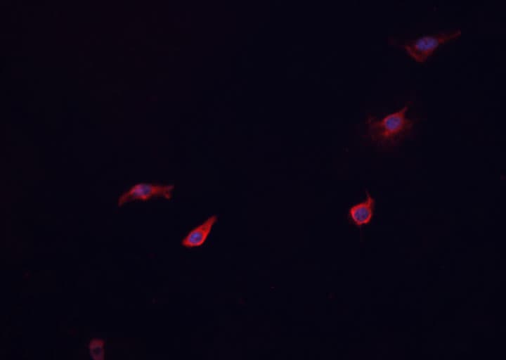 GCGR / Glucagon Receptor Antibody