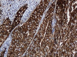 PAI-RBP1 / SERBP1 Antibody (aa1-262, clone OTI2C11)