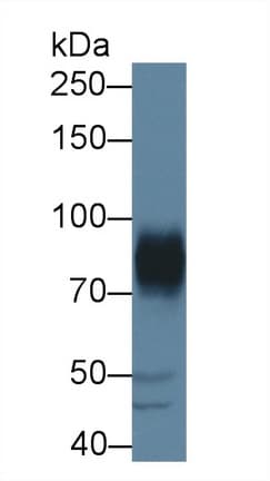 ADAM22 Antibody (aa370-582, Biotin)