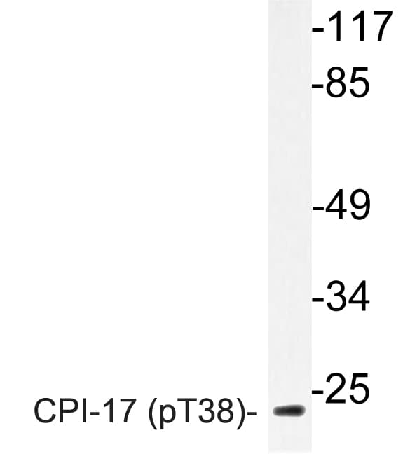 PPP1R14A / CPI-17 Antibody (phospho-Thr38)