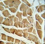 CAPN3 / Calpain 3 Antibody (aa603-632)