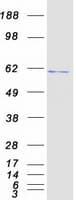 Human TS / Thromboxane Synthase Protein (Recombinant Myc-DDK (Flag))