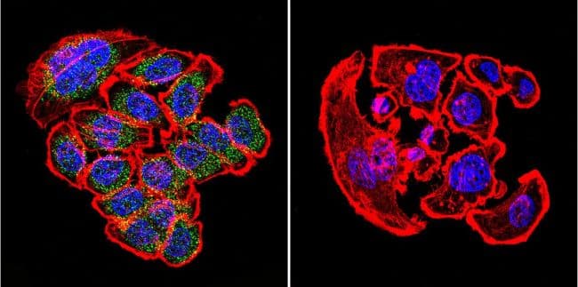 KDEL Tetrapeptide Antibody