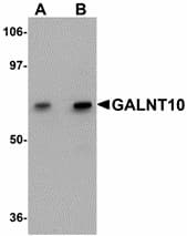 IHC-plus™ GALNT10 Antibody