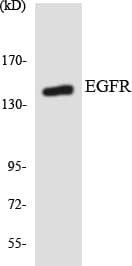 Polyclonal Rabbit anti-Human EGFR Antibody (aa1126-1175, WB)