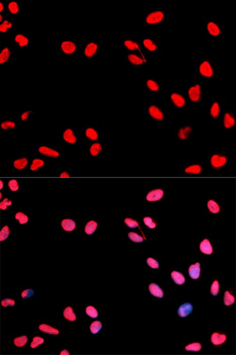 CCNE1 / Cyclin E1 Antibody (phospho-Thr395)