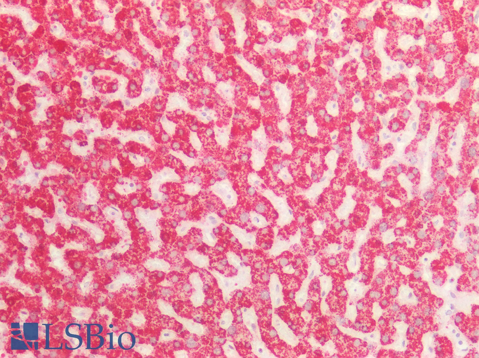 PathPlus™ ST6GAL1 / CD75 Antibody (aa178-206)