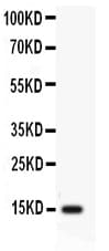 Polyclonal Rabbit anti-Human PFN2 / Profilin 2 Antibody (aa125-140, IHC, WB)