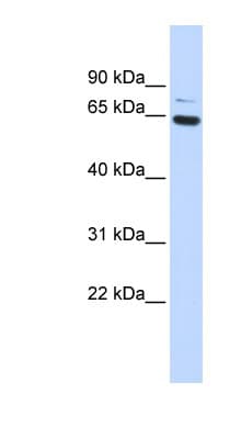 Polyclonal Rabbit anti-Human ZNF74 Antibody (aa216-265, WB)