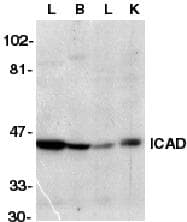 DFFA / ICAD / DFF45 Antibody (aa312-331)