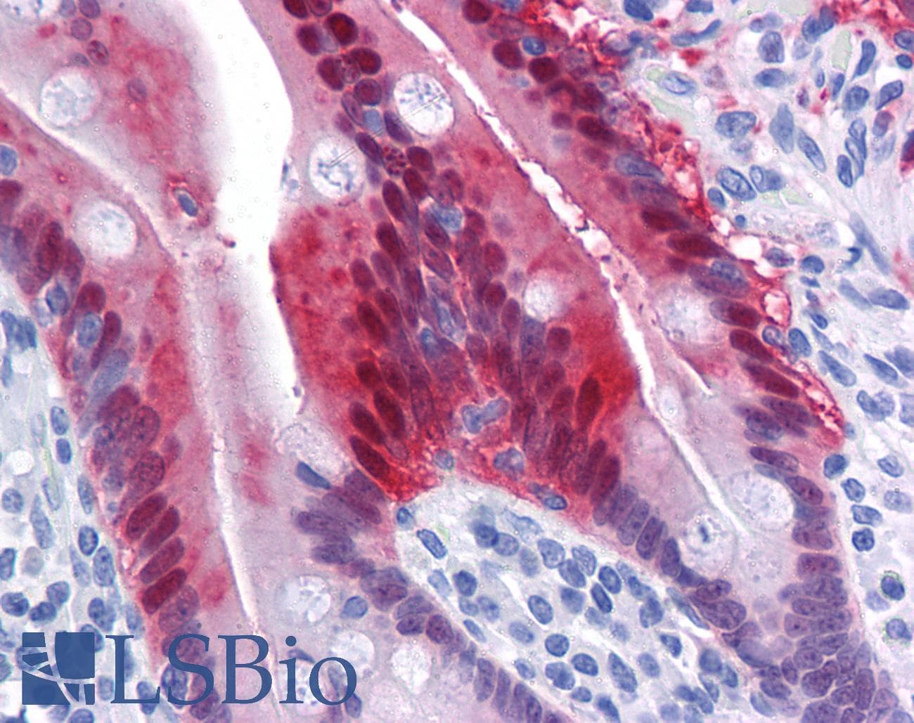 IHC-plus™ Monoclonal Mouse anti-Human AKR1B10 Antibody (clone 1A6, IHC, IF, WB)