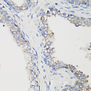 Polyclonal Rabbit anti-Human GLUD1/Glutamate Dehydrogenase Antibody (IHC, WB)