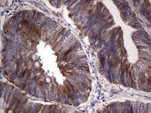 Monoclonal Mouse anti-Human R1 / RRM1 Antibody (clone OTI1F9, aa541-792, IHC)