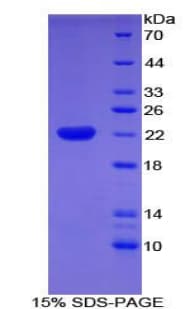 Human CFL2 / Cofilin 2 Protein (Recombinant His-T7)