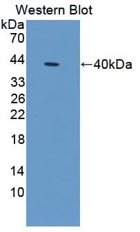 TPM3 Antibody (aa1-285, Cy3)