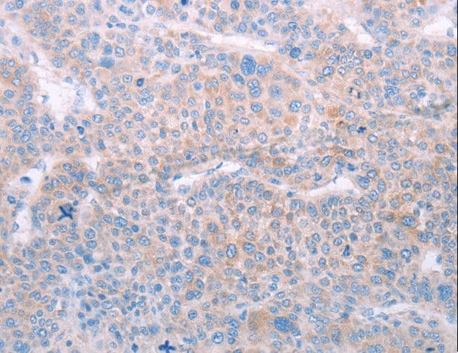 SPATA6 / SRF-1 Antibody
