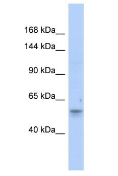 EPHB6 / EPH Receptor B6 Antibody (aa225-274)