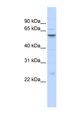 IGFALS / ALS Antibody (aa287-336)