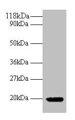 IFN Gamma / Interferon Gamma Antibody
