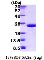 Mouse MUP1 / Major Urinary Protein (Recombinant His)