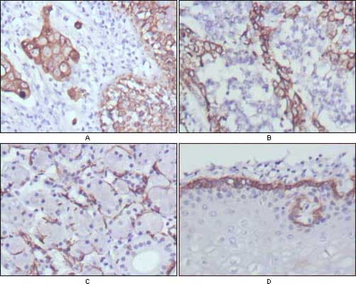 KRT17 / CK17 / Cytokeratin 17 Antibody (clone 3B12)