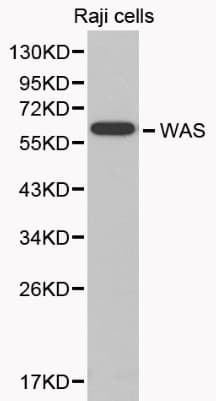Polyclonal Rabbit anti-Human WAS / WASP Antibody (IHC, WB)