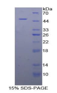 Human CPE / Carboxypeptidase E Protein (Recombinant His-GST)