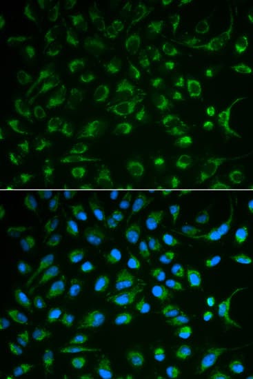 IHC-plus™ Polyclonal Rabbit anti-Human NT5E / eNT / CD73 Antibody (IHC, IF, WB)