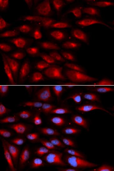 Polyclonal Rabbit anti-Human AZGP1 / ZAG Antibody (IHC, IF, WB)