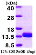 Human TSTD1 Protein (Recombinant His)