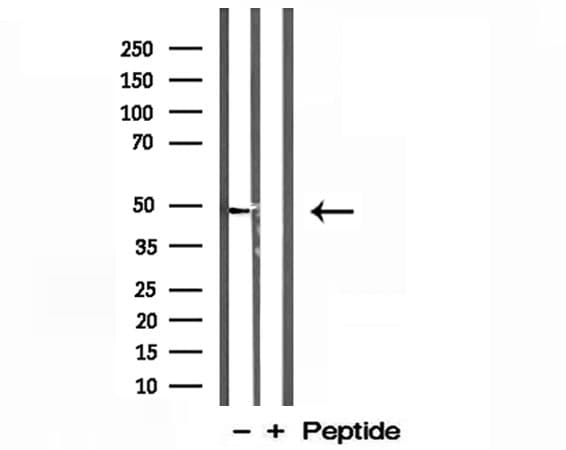 L2HGDH Antibody