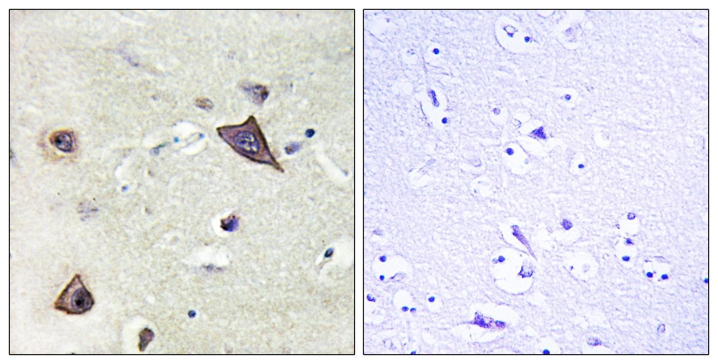 GRIN1 / NMDAR1 Antibody (p896)