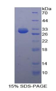 Human NUP160 Protein (Recombinant His-T7)