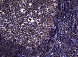 NBN / Nibrin Antibody (clone OTI2E9)