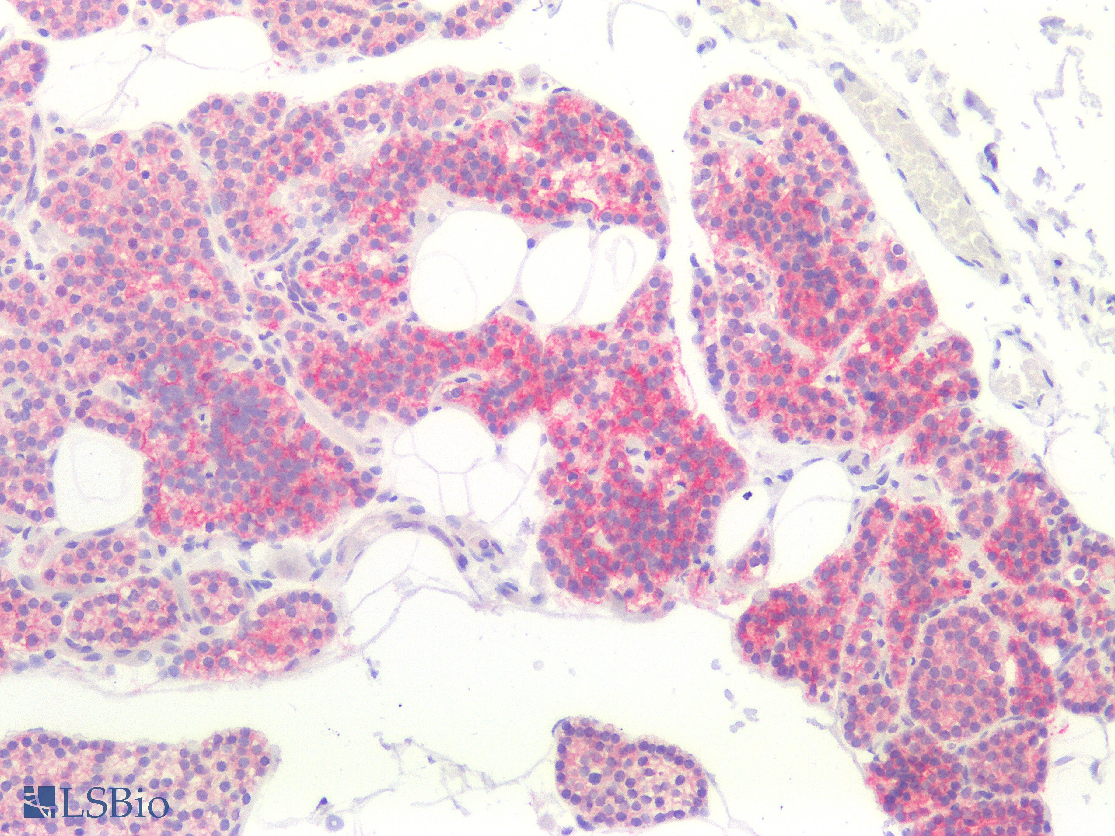 PathPlus™ Recombinant Monoclonal Rabbit anti-Human ANO1 / DOG1 / TMEM16A Antibody (clone DG1/2564R, aa 2-101, IHC)