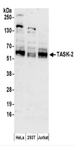 KCNK5 / TASK2 Antibody (aa425-475)